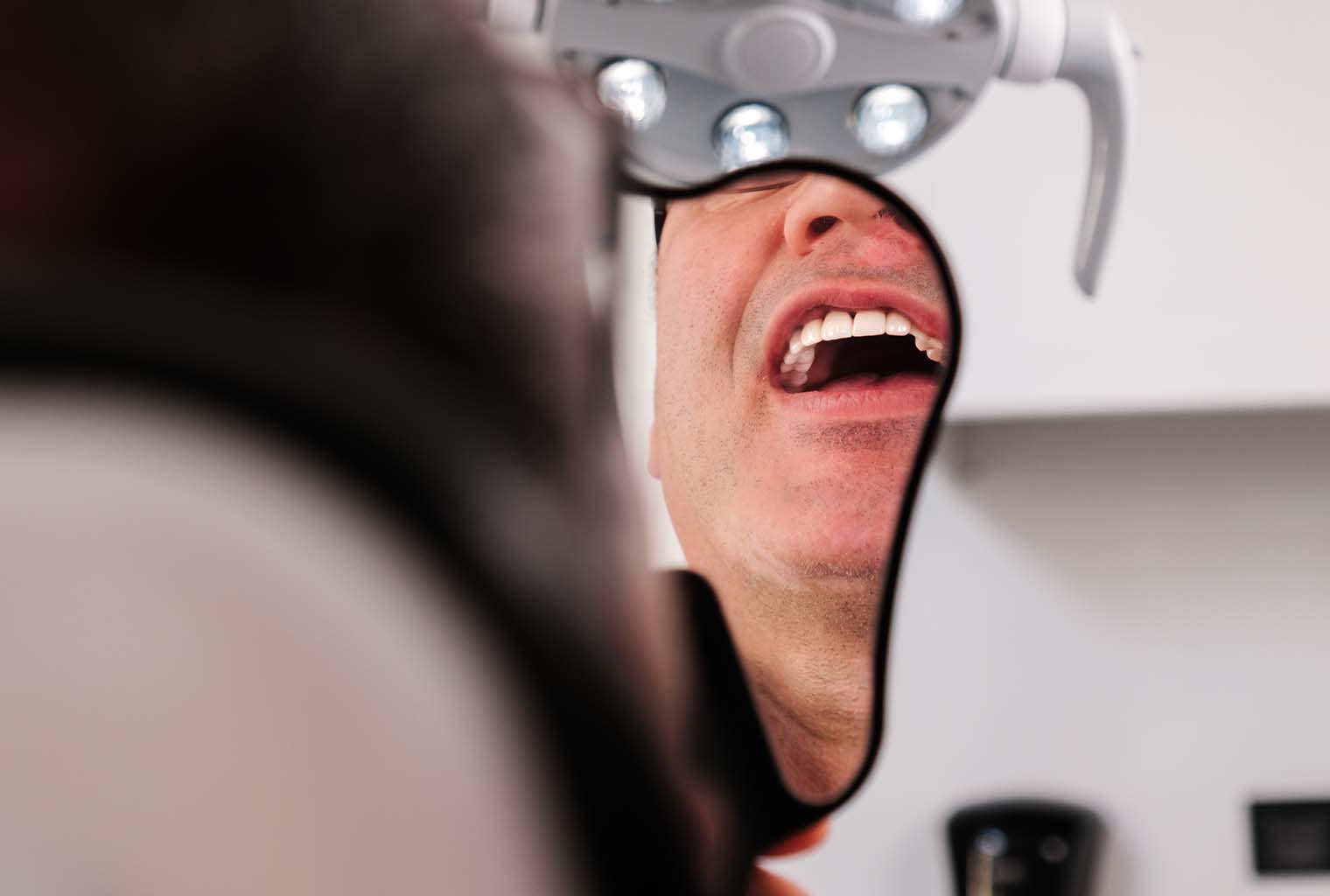 Diş Beyazlatma Yöntemleri ve Karşılaştırması: Nihai Rehberiniz