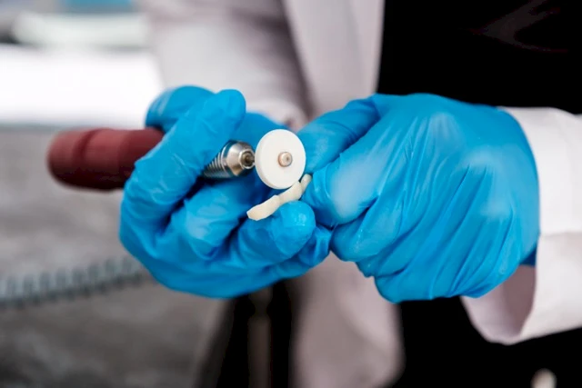 Does Insurance Cover Dental Implant Treatment?