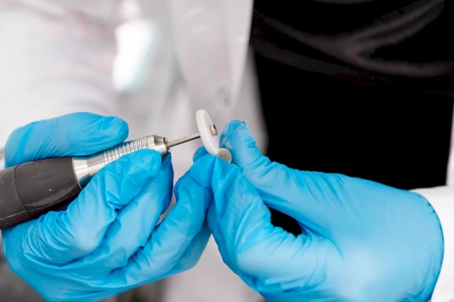 Frequently Asked Questions About Dental Implant Treatment