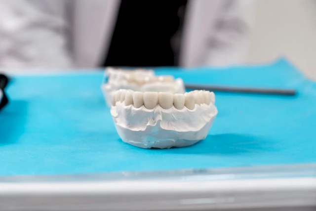 Getting Dental Implant Treatment in Turkey