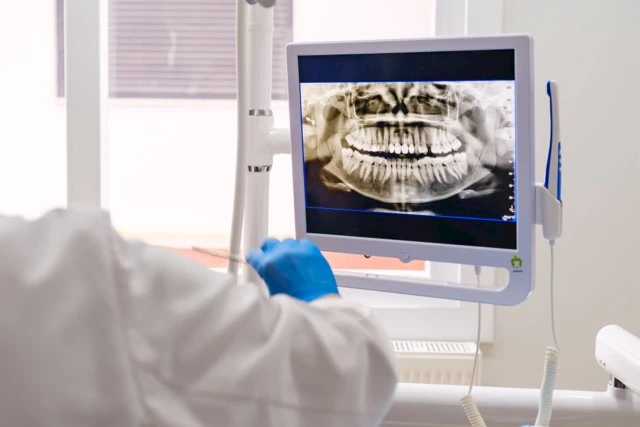 Dental Cleaning - What is Scaling and Polishing?