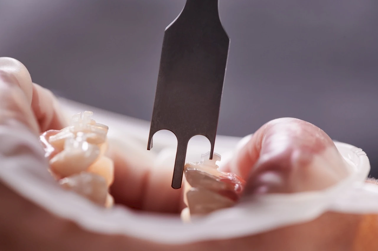 Zirconia Crowns Price in Turkey